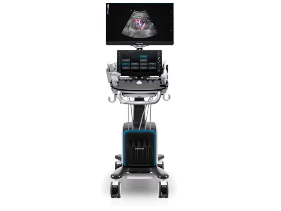 Consona N9 Ultrasound System