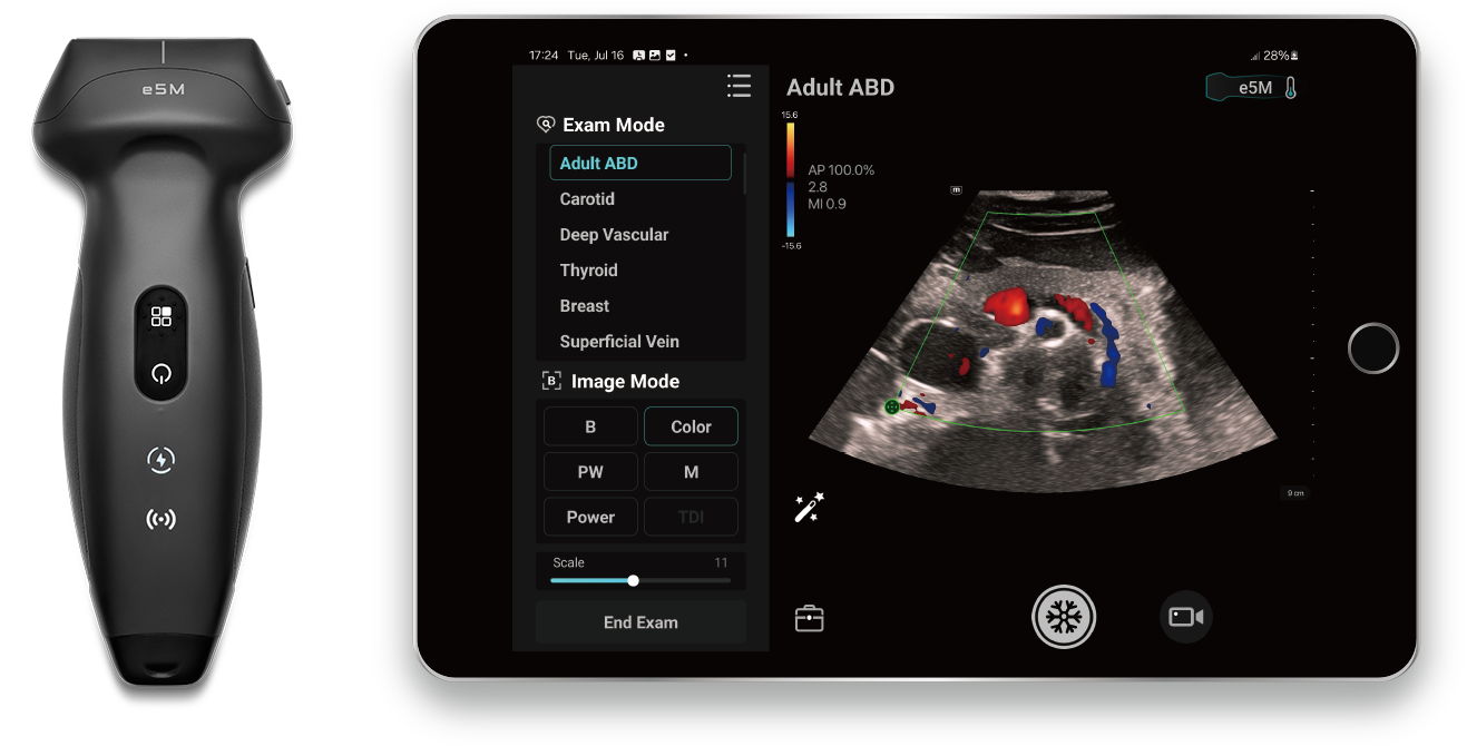 TE Air Wireless Ultrasound